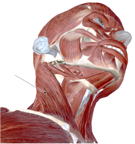 <p>Name the muscle</p>