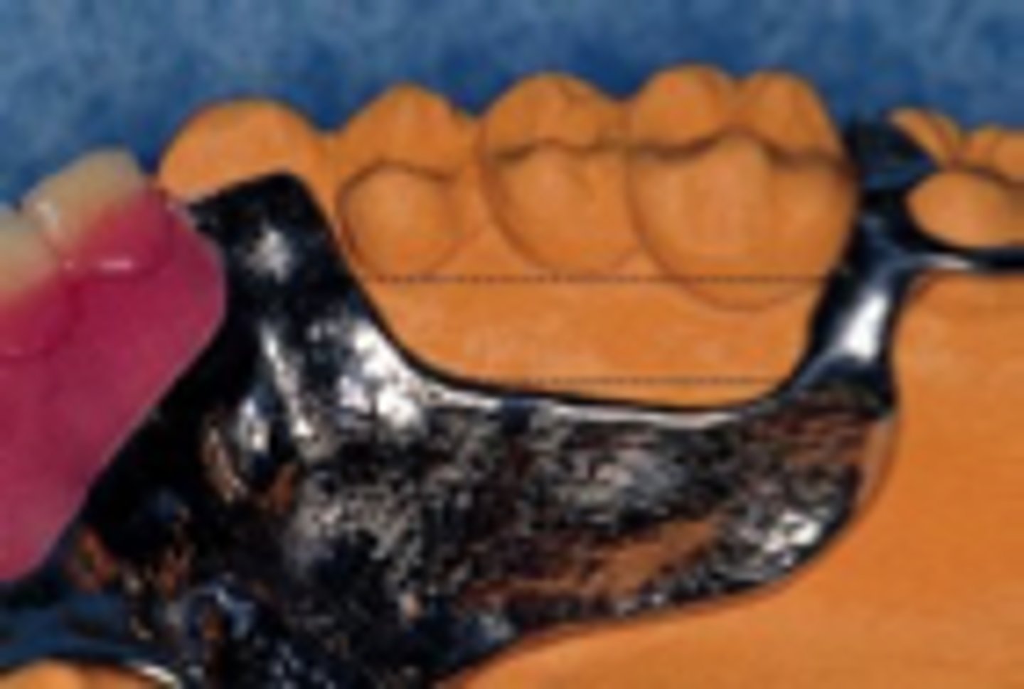 <p>The borders of the major connector should run _______ to the free gingival margins of the remaining teeth</p>