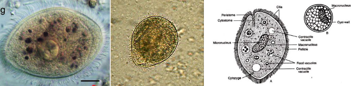 <p class="Paragraph WhiteSpaceCollapse SCXP130049695 BCX0" style="text-align: left"><span>the <strong>only ciliates that causes disease to humans</strong>​</span></p><p></p>