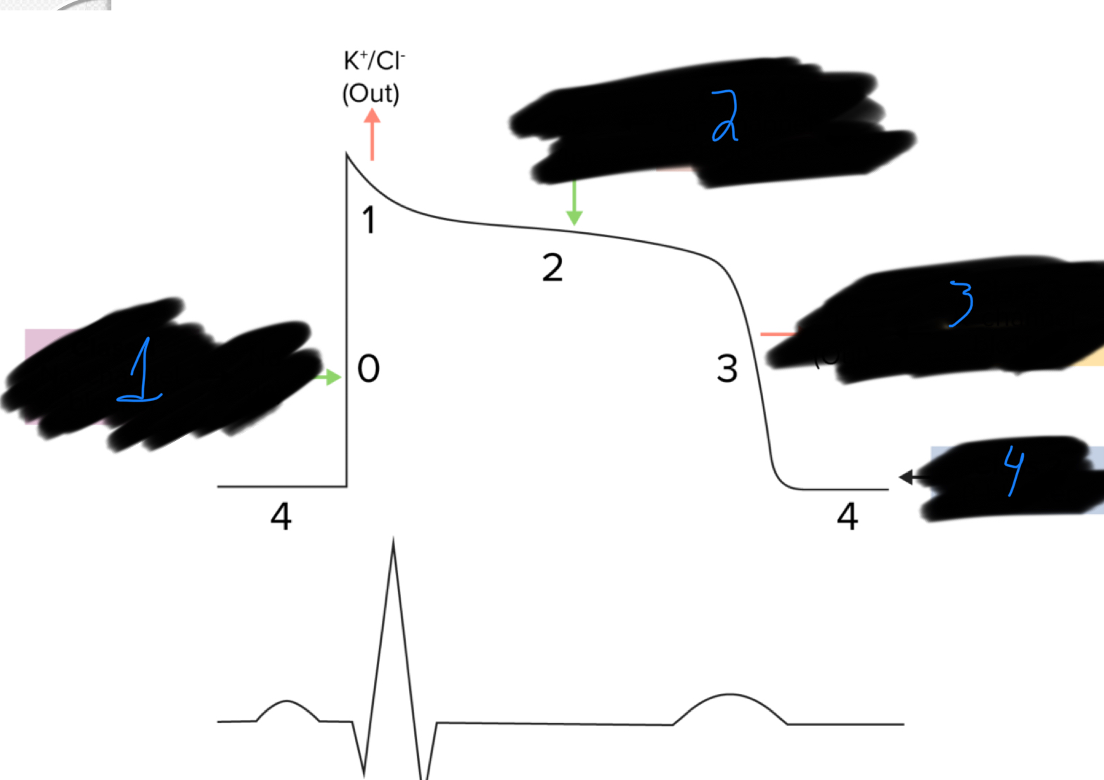 <p>Which class of anti-arrhythmic drug acts at each point of the graph?</p>