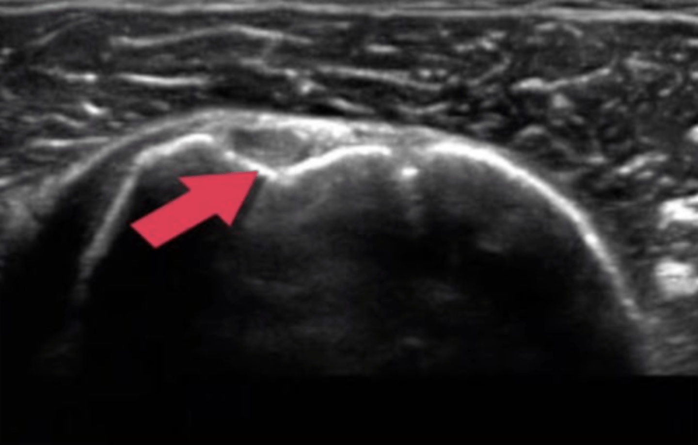 <p>Is there ionizing radiation associated with this type of imaging procedure?</p><p>a. yes</p><p>b. no</p>