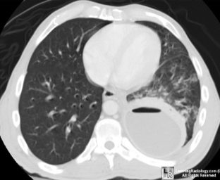 <p>Name the pathology</p>