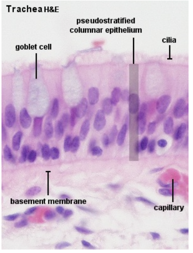 <p>A type of epithelium that appears stratified but is actually a single layer where:</p><ul><li><p>All cells contact the basement membrane</p></li><li><p>Not all cells reach the surface</p></li><li><p>Has a lot of cilia</p></li></ul><p></p>