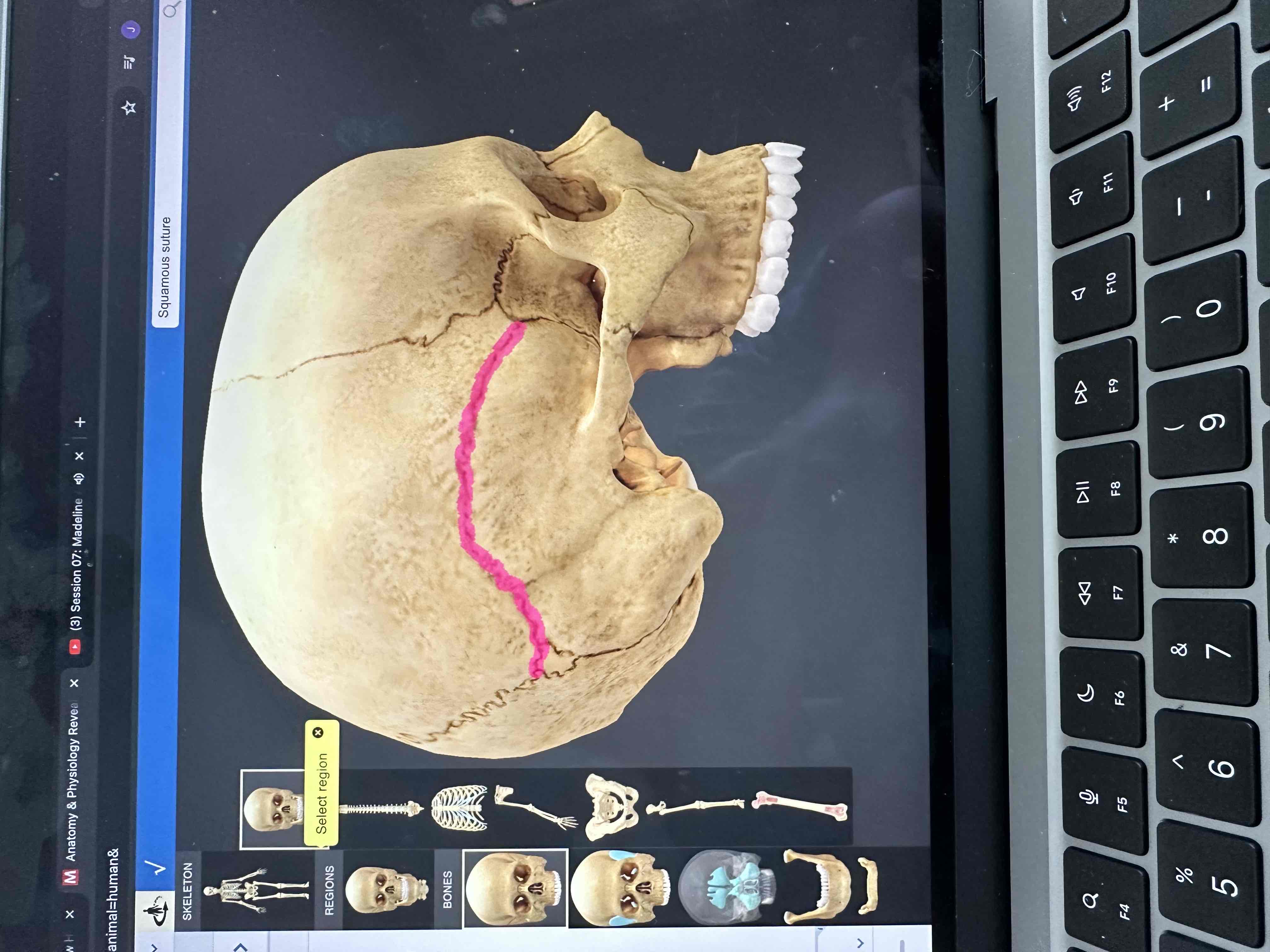 <p>• separate the parietal bones from the superior portion of the temporal bones.</p>