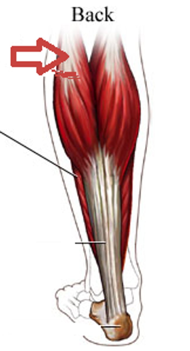 <p>L: Posterior aspect of leg</p><p>A: Flexes leg; plantar flexion (agonist)</p><p>O: Distal femur</p><p>I: Calcaneus via canaeal (Achilies) tendon</p>
