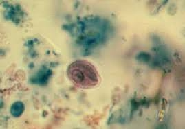 <p>Identify this small protozoan cyst.<br></p><p>Chilomastix mesnili</p><p>Endolimax nana</p><p>Entamoeba hartmanni</p><p>Giardia lamblia</p><p>Trichomonas vaginalis</p>