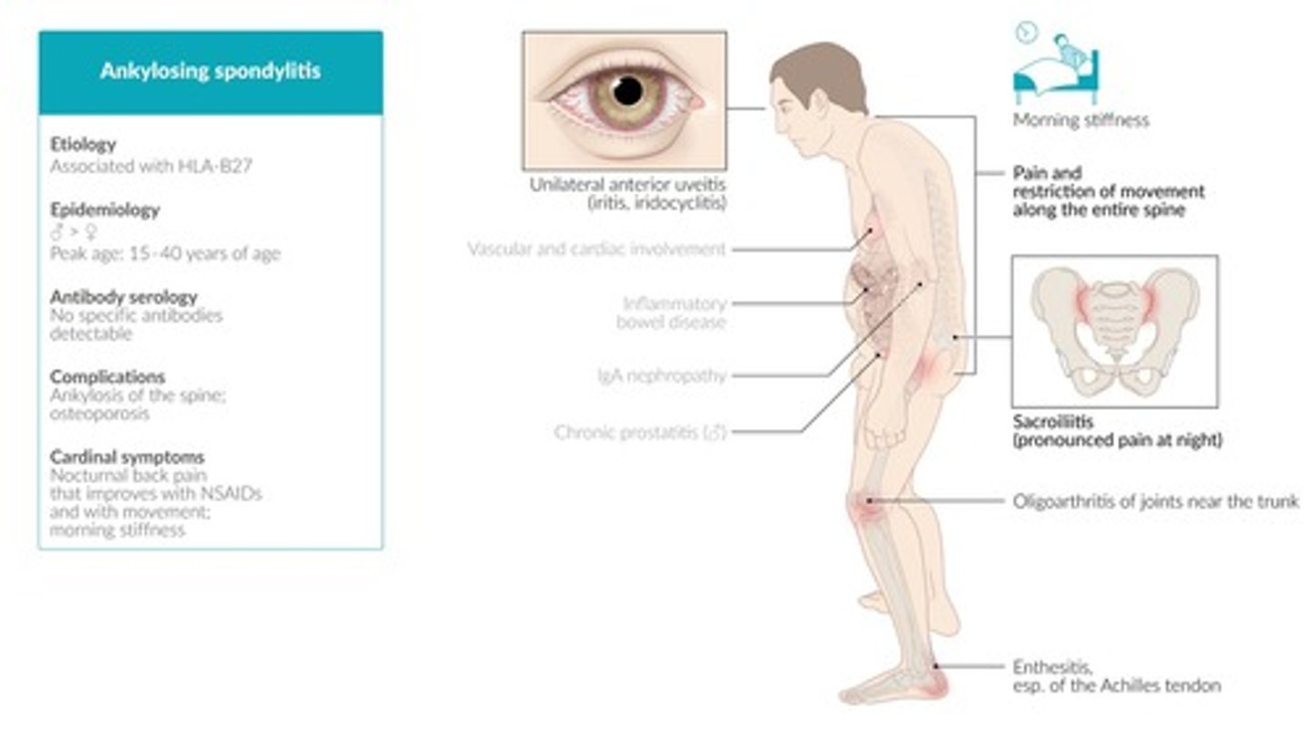 <p>1. Psoriasis<br>2. Inflammatory spine and buttock pain<br>3. Good response to NSAIDs<br>4. Enthesitis <br>5. Arthritis <br>6. Crohn's/colitis associated <br>7. Uveitis</p>