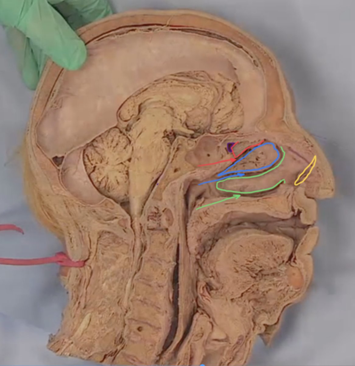 <p>identify blue arrow</p>