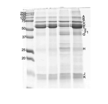 <p>Based on the “Amylase” gel, which band do you think contains the amylase protein?</p>