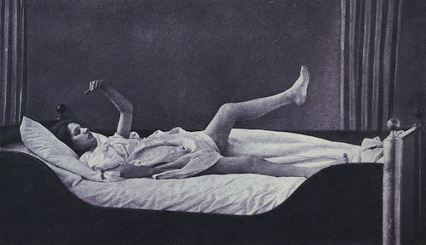 <p>a negative symptom of schizophrenia characterized as unresponsiveness (e.g., lack of movement, isolation, withdrawal, mutism, bizarre posture)</p>