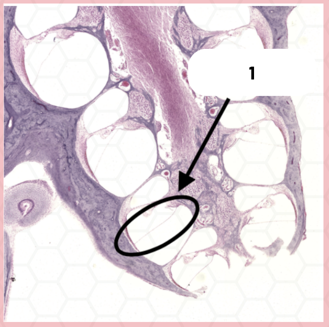 <p>Identify the structure labeled as 1.</p>