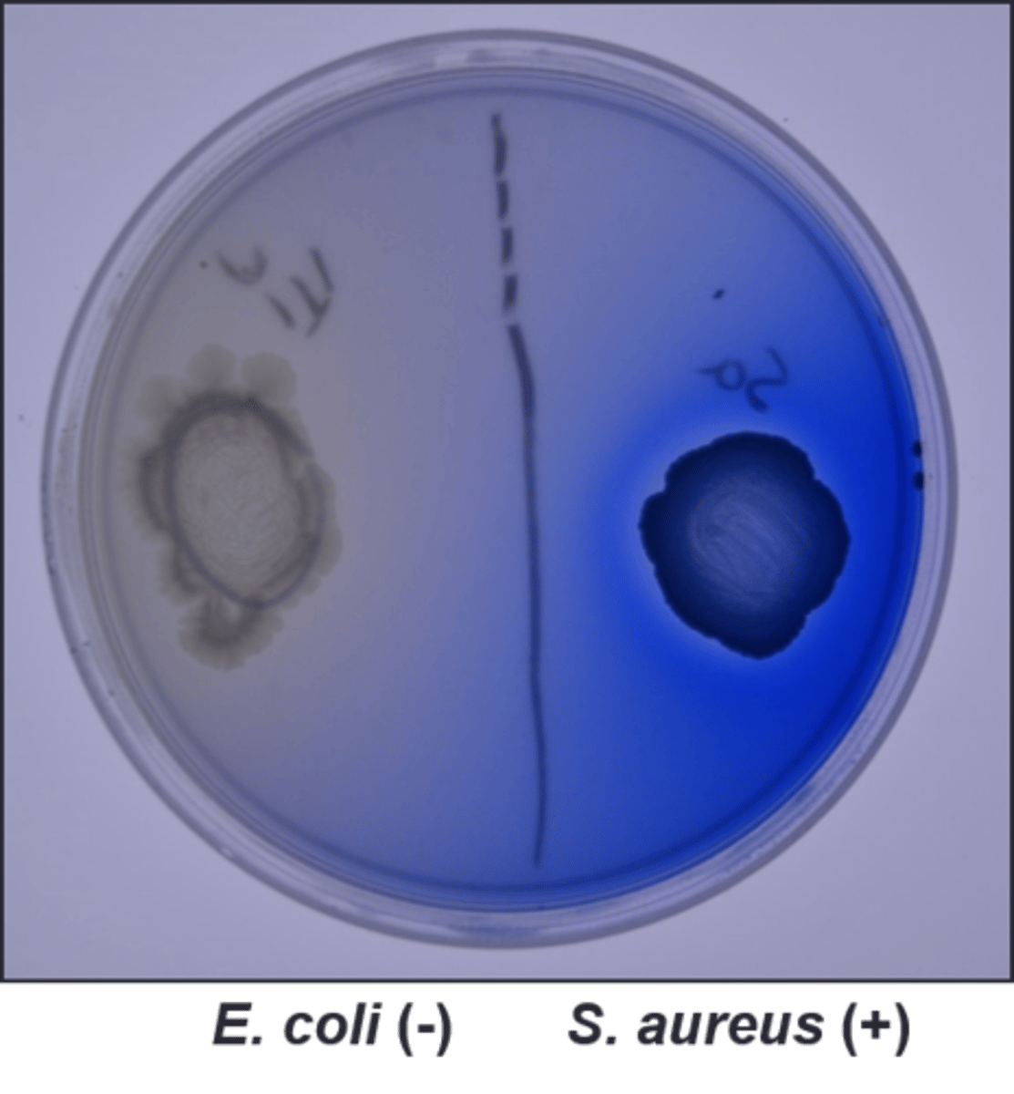 <p>Lipase Plate</p><p>Selective:</p><p>Differential:</p><p>Dyes/Reagents:</p>