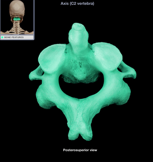 <ul><li><p>Location: Neck, Between atlas (C1 vertebra) and C3 vertebra</p></li></ul><ul><li><p>Description: Characteristic features include transverse foramen, bifid (split) spinous process, and dens (prominent superior projection from body)</p></li><li><p>Also known as: C2 vertebra</p></li></ul><p></p>