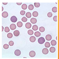 <p><span style="color: rgb(255, 255, 255);"><span>Mycoplasma haemofelis</span></span></p>