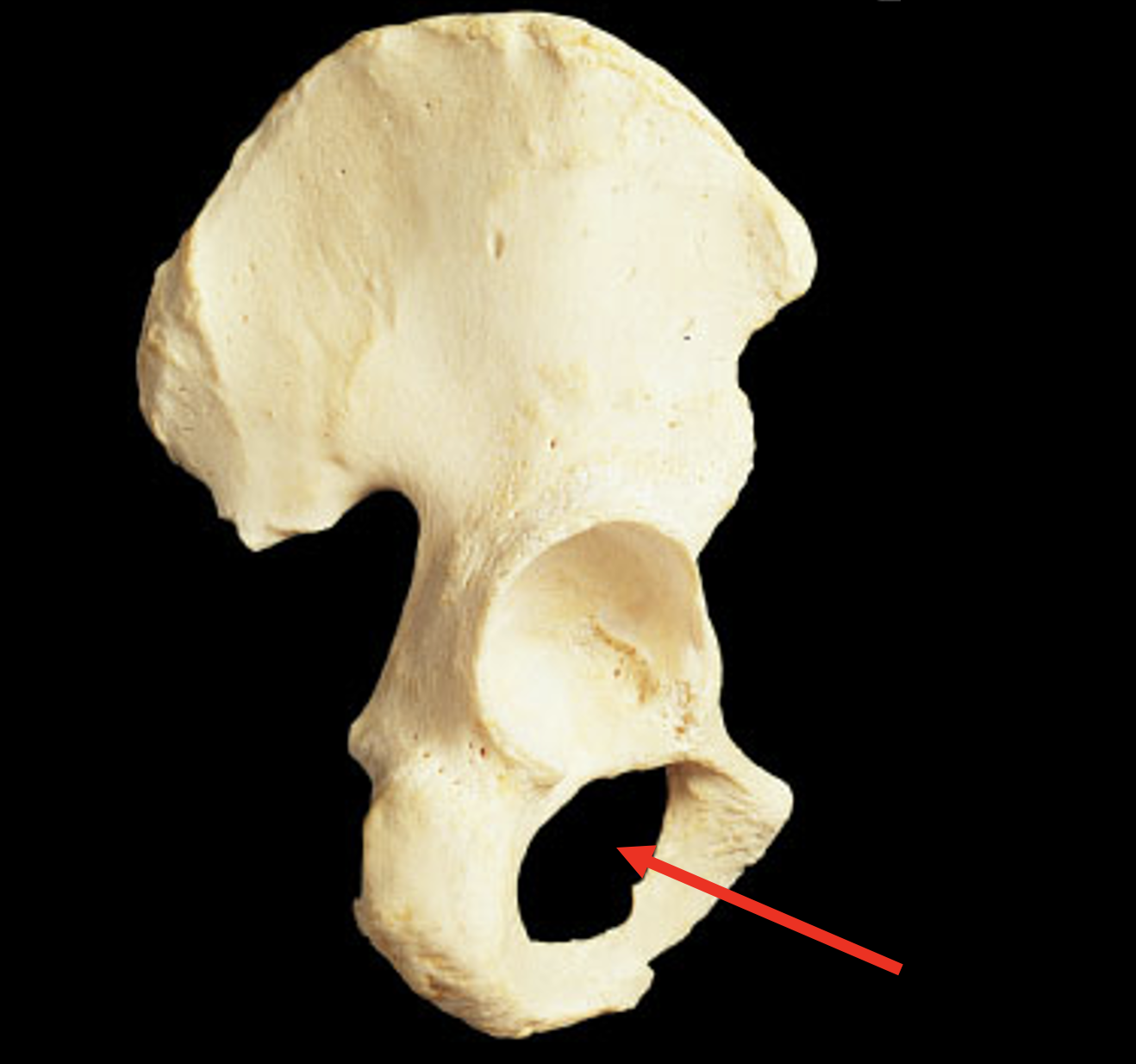 Name this region of the pelvis