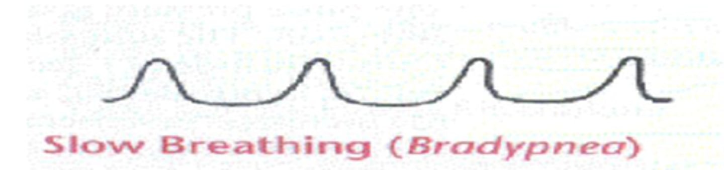 <p>abnormally slow breathing</p>