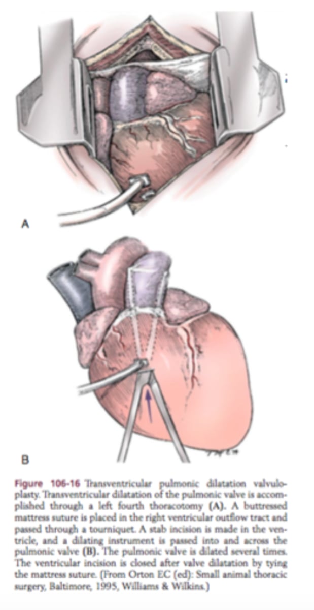 <p>surgical repair of a valve</p><p>* Commissurotomy - repair of the commissure (area where the leaflets connect)</p><p>* Annuloplasty - repair of the annulus</p><p>* Leaflet Repair - repair of the leaflets</p><p>* Chordoplasty - repair of the chordae tendineae</p>