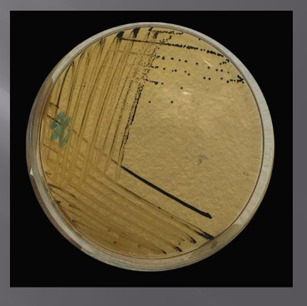 <ul><li><p>принадлежи към сем. Enterobacteriaceae</p></li><li><p>факултативни анаероби</p></li><li><p>Ферментиращи глюкоза, манитол и сорбитол</p></li><li><p>грам-отрицателни пръчици</p></li><li><p>перитрихи с изключение на S. pallinarum→подвижни</p></li><li><p>Не образуват същински капсули</p></li><li><p>нямат спори</p></li><li><p>под въздействие на химични, физични и биологични фактори могат да променят морфологията си и да придобият нишковидна или коковидна форма, да загубят ресните си(полиморфни)</p></li><li><p>невзискателни</p></li><li><p><span><span>върху диференциращите<br>хранителни среди образуват лактозонегативни<br>колонии, върху селективните хранителни среди<br>образуват колонии с черен център, поради<br>продукцията на H2S<br></span></span></p></li></ul><p></p>