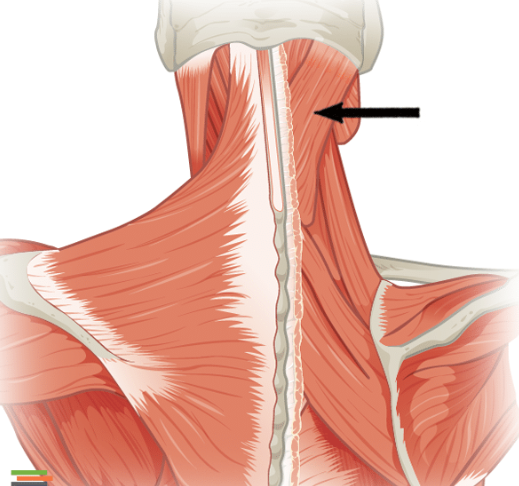 <p>What is the name of this muscle?</p>