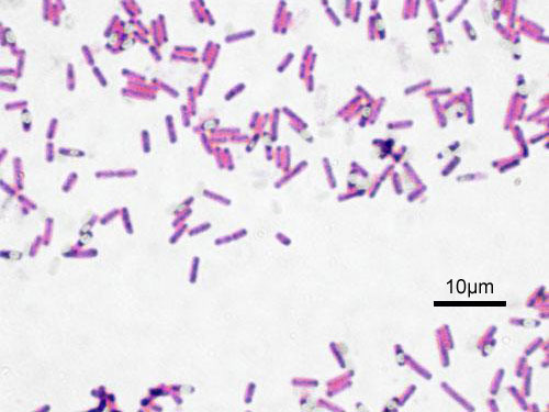 <p>What shape of bacteria is this?</p>
