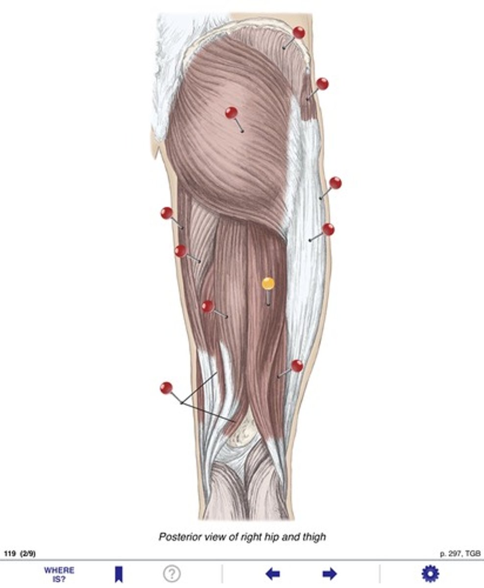 <p>Name the muscle at the yellow pin</p>
