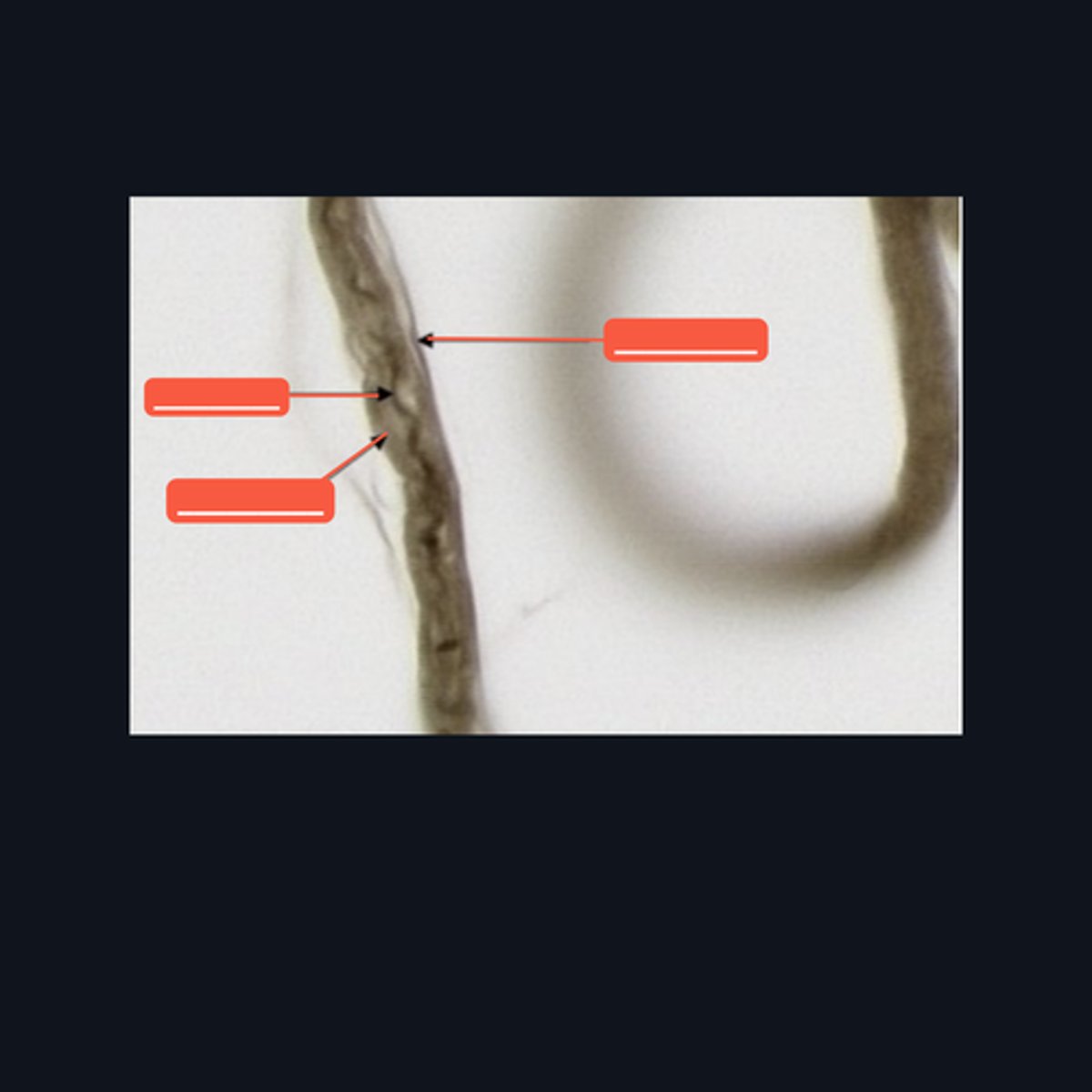 <p>Identify the structure on the image.</p>