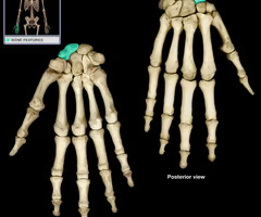 <p>Largest bone, attachment to forearm</p>
