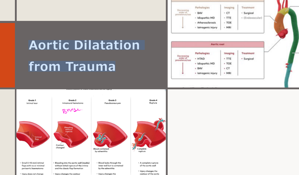 <p>also…Aortic Dissection</p><p>And last but definitely not</p><p>least...Aortic dissection</p><p>Always look for the presence and</p><p>severity of aortic regurgitation</p>