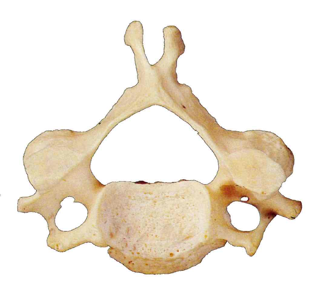 <p>Defining factor of cervical vertebrae</p>