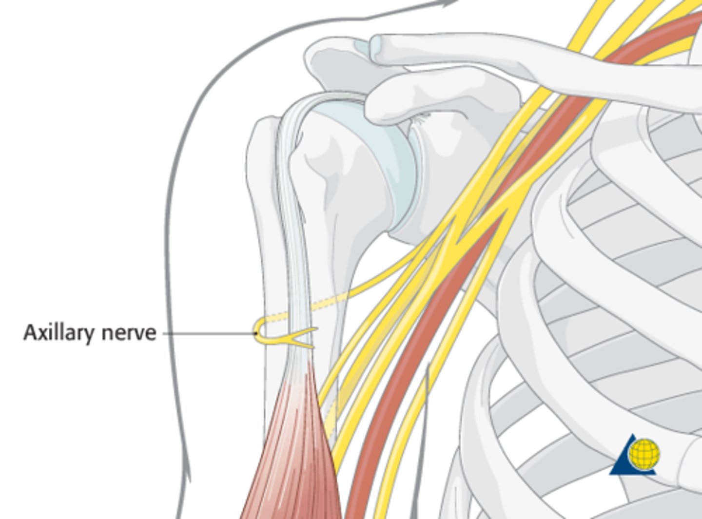 <p>Spinal Roots: C5 - C6</p><p>Cause of Injury:</p><p>- fractured surgical neck of the humerus</p><p>- anterior dislocation of the humerus</p><p>Presentation:</p><p>- flattened deltoid</p><p>- inability to ABduct at the shoulder (can't go > 15 degrees; first 15 by supraspinatus)</p><p>- loss of sensation over deltoid muscle and lateral arm</p>