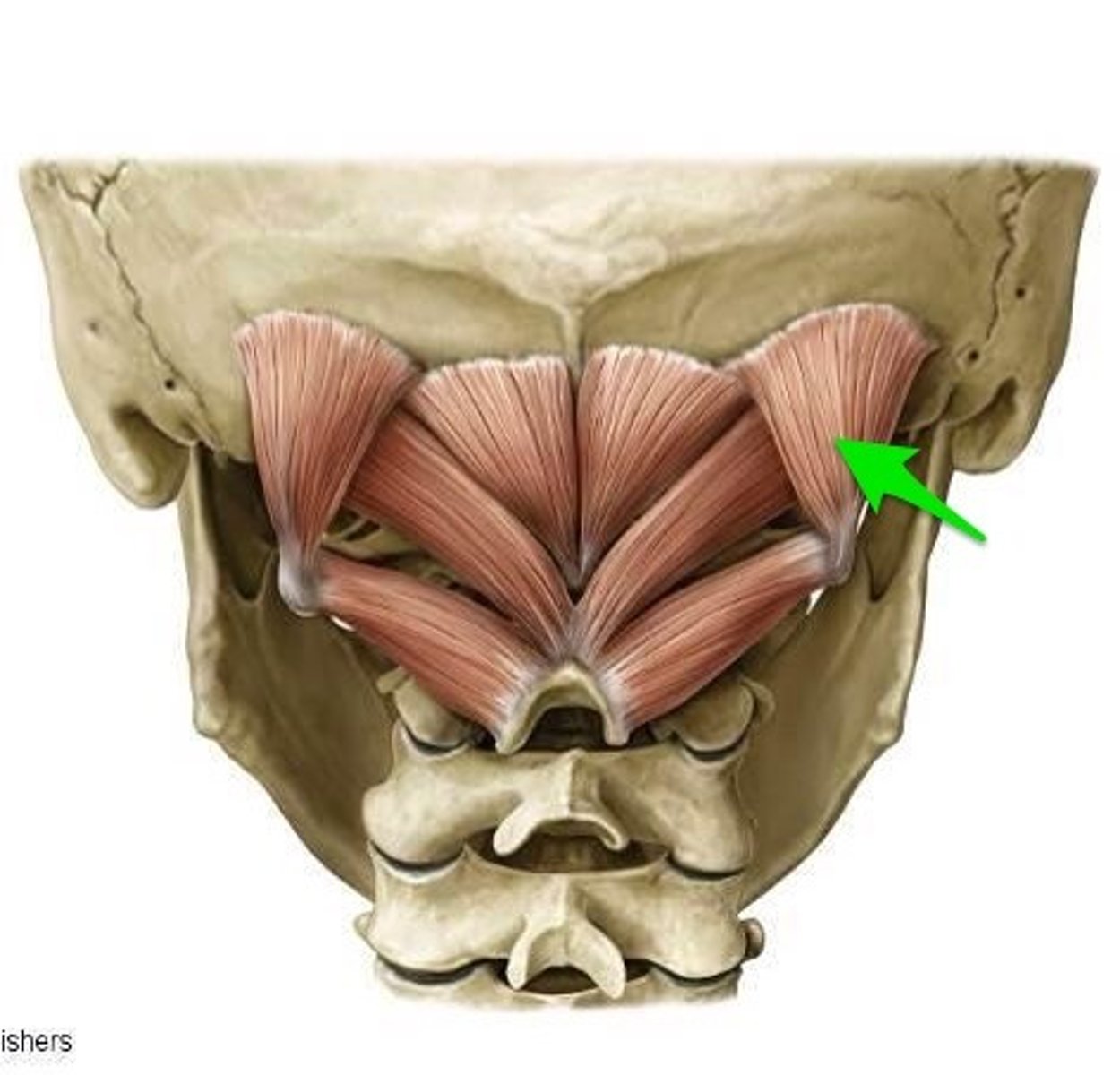 <p>head extension, rotation, lateral flexion</p><p>O: transverse process of atlas</p><p>I: occipital bone between inferior/superior nuchal lines</p><p>N: suboccipital nerve (dorsal ramus of C1)</p>