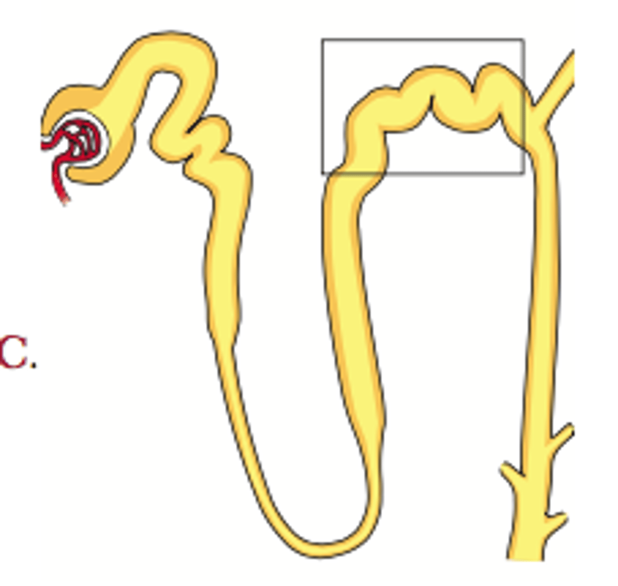 <p>hydrochlorothiazide (HCTZ), chlorothiazide, indapamide, chlorthalidone</p><p>- developed from carbonic anhydrase inhibitors </p><p>- MOA: blocks the Na/Cl transporter in the distal convoluted tubule</p><p>> lowers BP 15-20 mmHg</p><p>- used for HTN (often 1st line!) and edema</p><p>- benefits: well tolerated, safe, inexpensive, reduces blood volume and ECF volume</p><p>- other effects: reduction in serum K+ (avoid in arrhythmias), reduced Ca++ excretion (avoid in hyperCa), reduced uric acid excretion (avoid in gout)</p><p>- ADE: hypoK+, hyperlipidemia, hyperuricemia, hyperglycemia (diabetes), hypersensitivity risk in sulfonamide allergies</p>