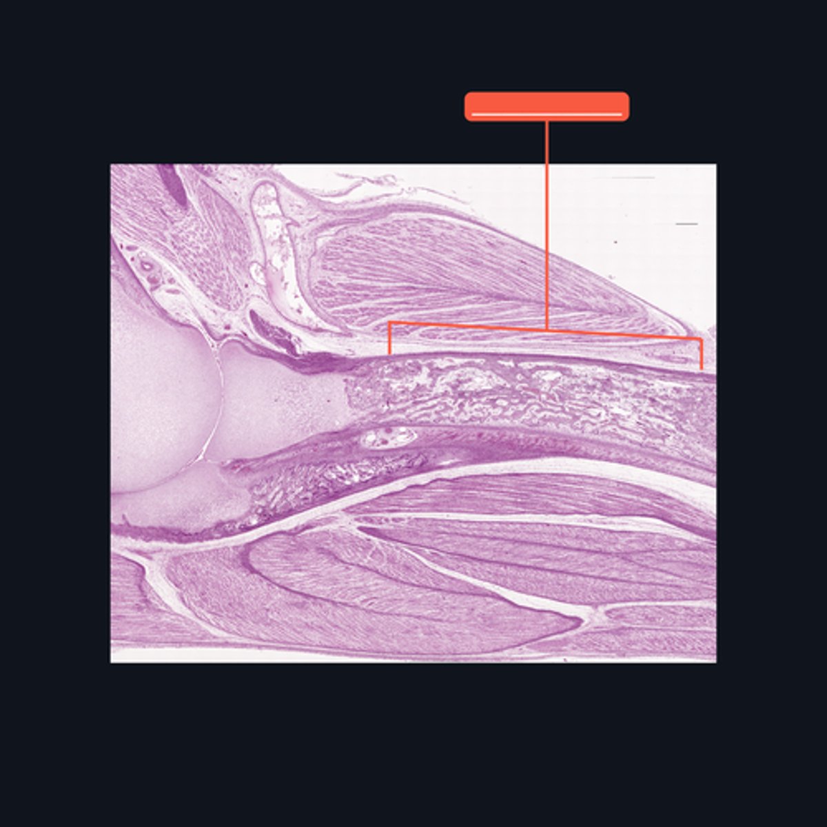 <p>Identify what part of a typical long bone is encompassed by the bracket symbol. It is also known as the _____ of a long bone.</p>