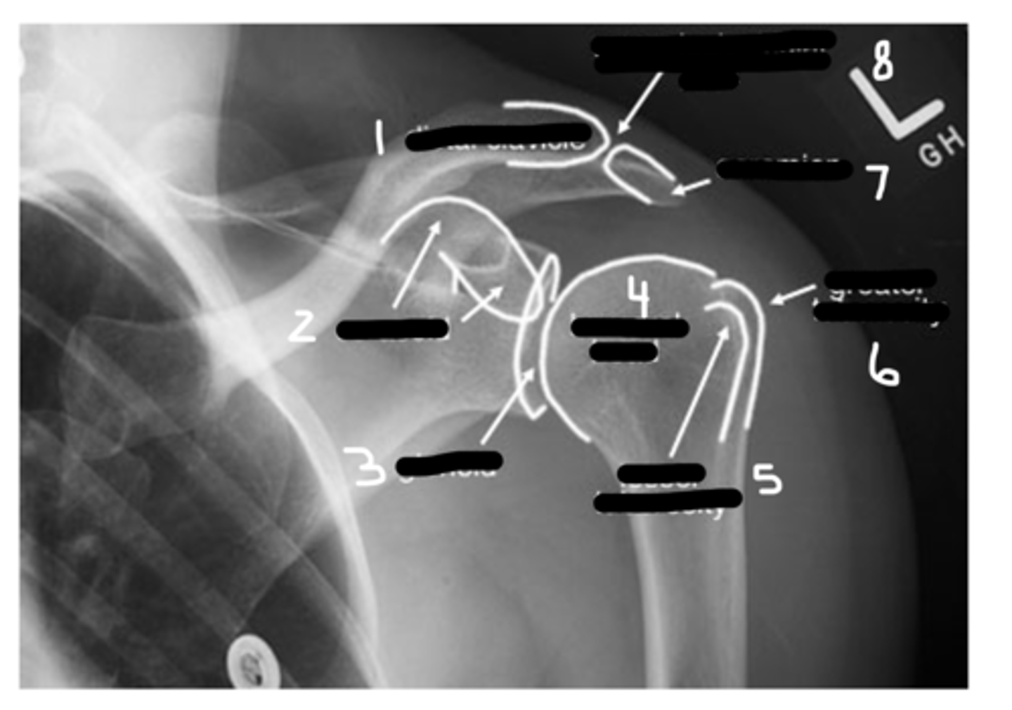 <p>Label this image.</p>