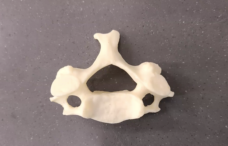 <p>what type of vertebal is this</p>