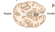 <p>horizontal plane that divides the brain into upper and lower sections.</p>