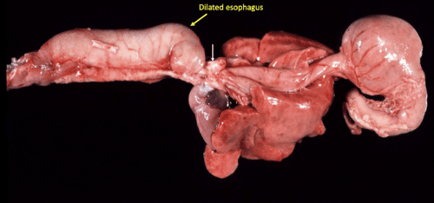 <p>- Persistent right 4th aortic arch leading to esophageal entrapment and megaesophagus, creating a risk of aspiration pneumonia</p>