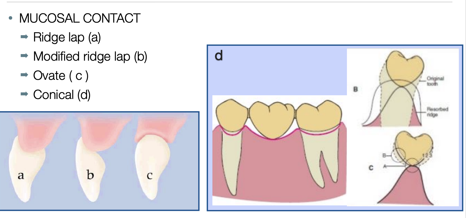 <ul><li><p>ridge-lap </p></li><li><p>modified ridge-lap </p></li><li><p>ovate </p></li><li><p>conical </p></li></ul><p></p>