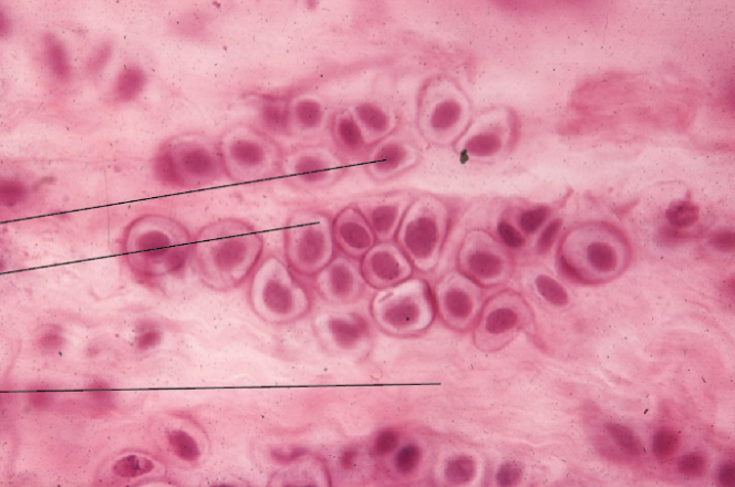 <p>What type of cartilage is this?</p>