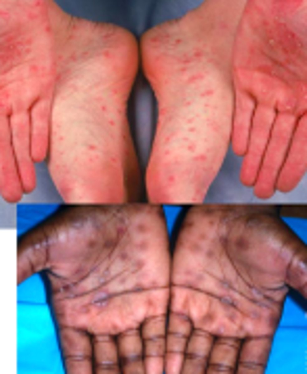 <p>Bacterial ID:</p>