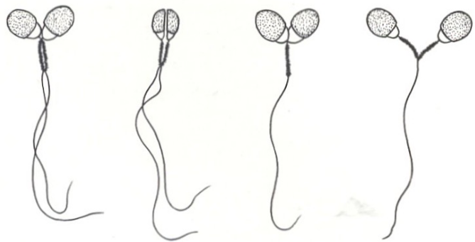 normal: about 10%

more than 20% of spermatozoa being abnormal can result in reduced fertility

defects in the axonemal structure cause defects in the sperm motility
=> this often leads to male infertility