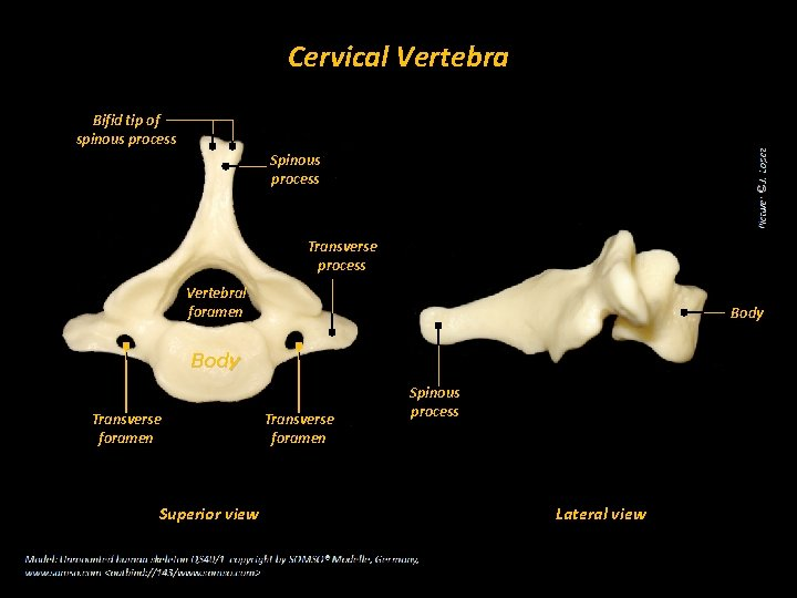 <p>long portion of the vertebra, splits into 2</p>