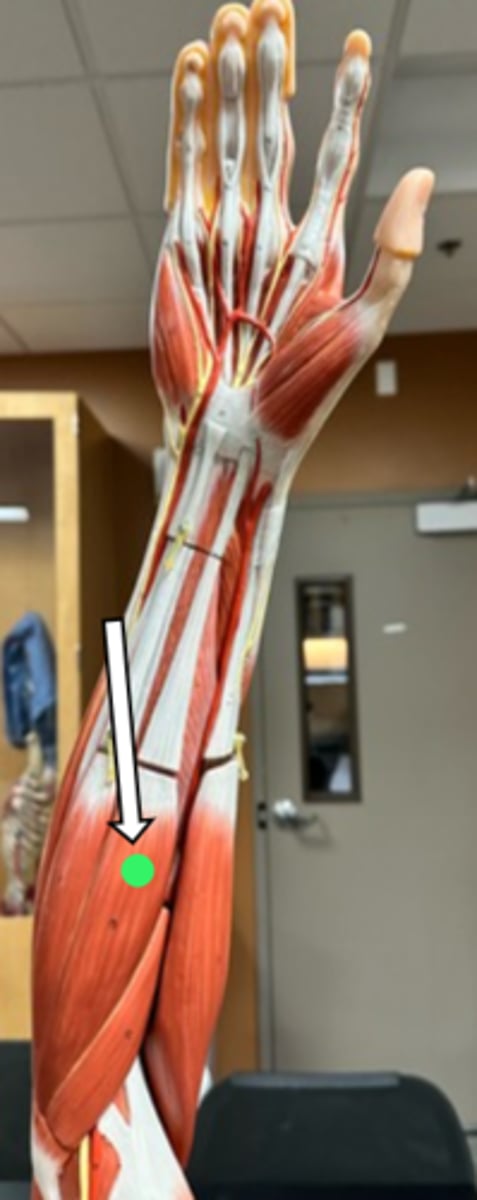 <p>flexor carpi radialis (function)</p>