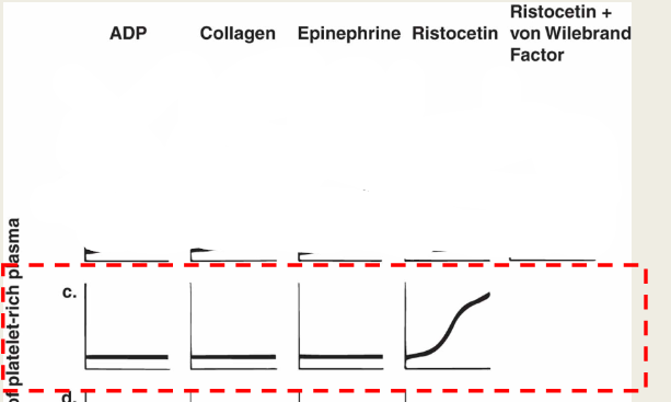 <ul><li><p>ADP: abnormal</p></li><li><p>Epinephrine: abnormal</p></li><li><p>Collagen: abnormal</p></li><li><p>Ristocetin: norm</p></li><li><p>Ristocetein +NL plasma: norm</p></li></ul><p></p>