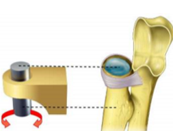 <p>What type of joint is this?</p>