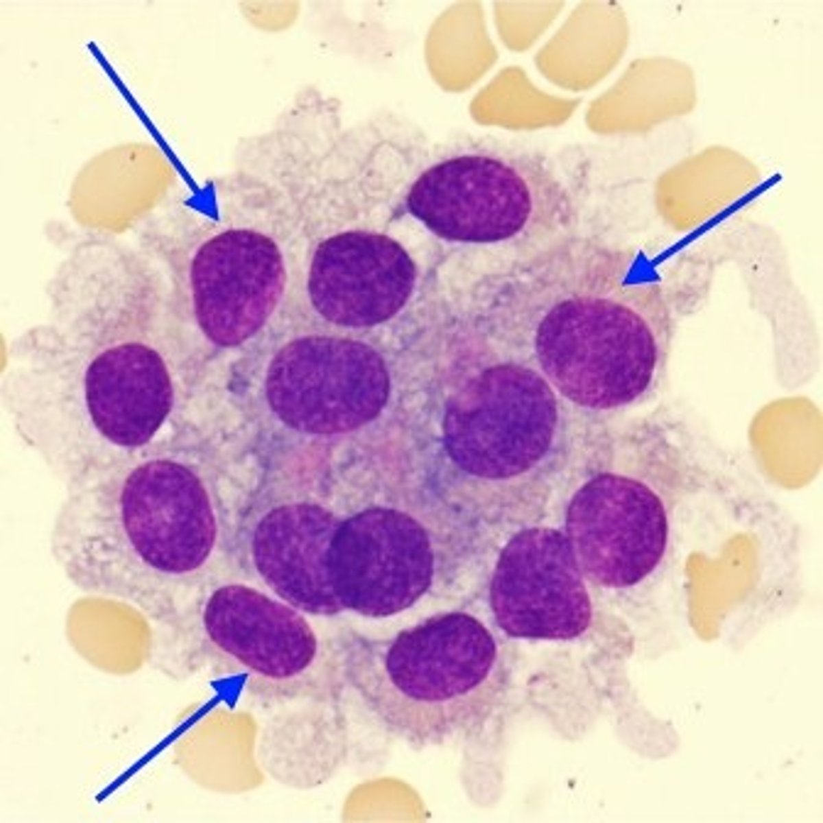 <p>Can also be more strung out</p>