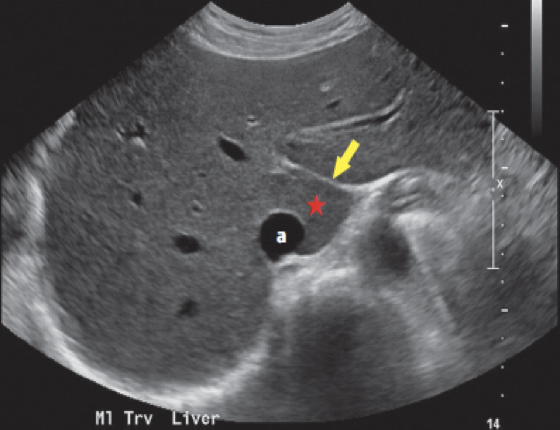 <p>What is the arrow pointing at?</p>