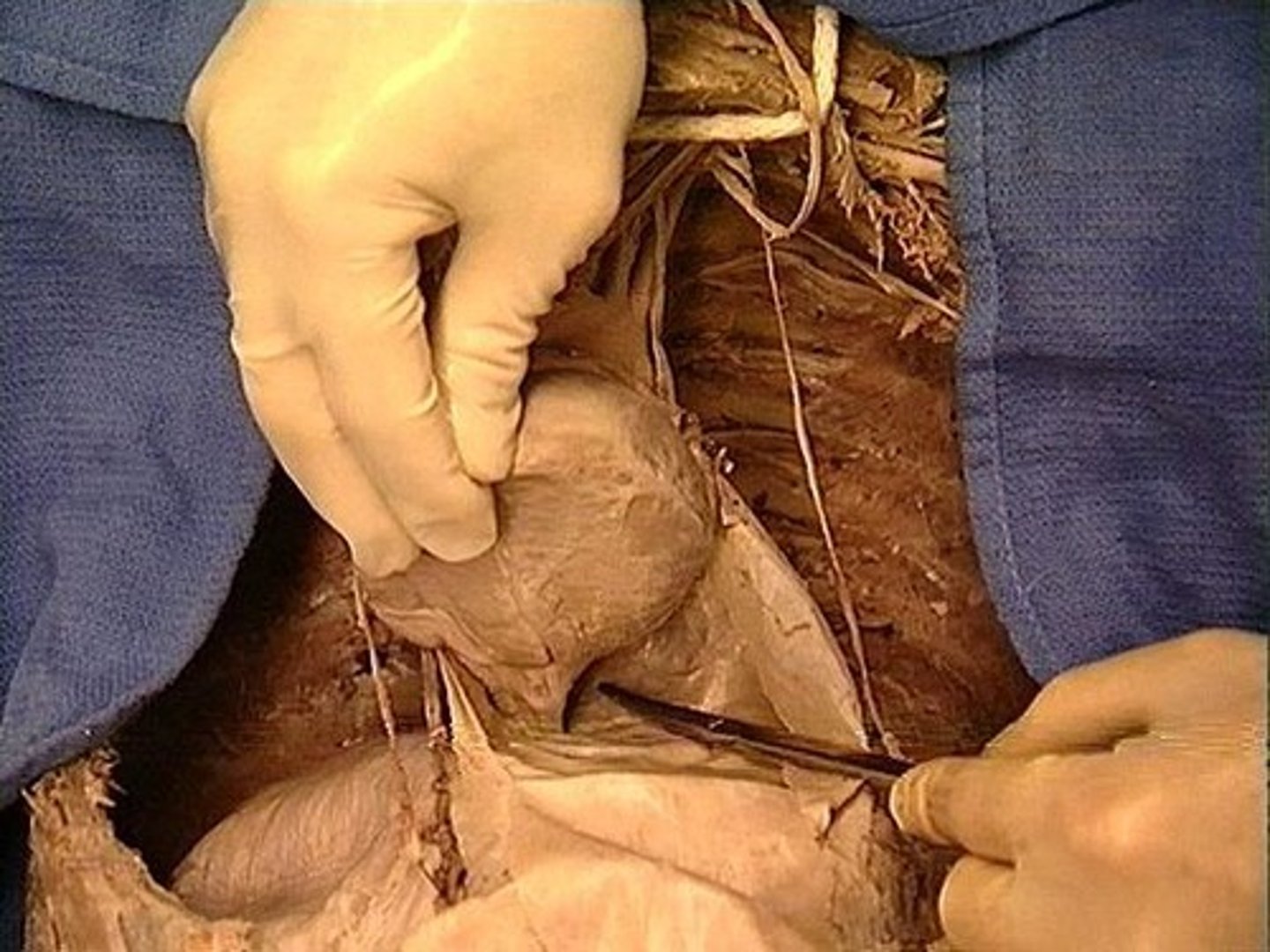 <p>at base of heart</p>