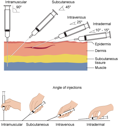 <p>intramuscular</p>