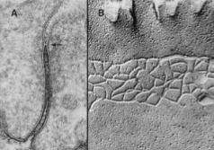 <p>what kind of intercellular jxn is this&nbsp;</p>